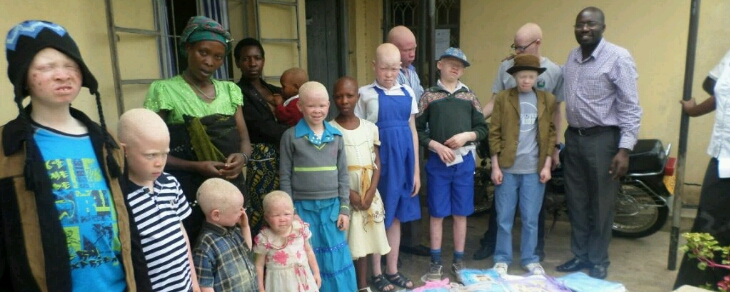 group photo of children with albinism