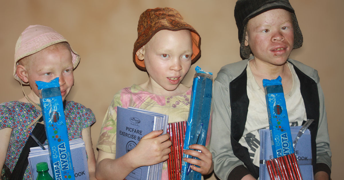 sponsored children with albinism after receiving scholastic items